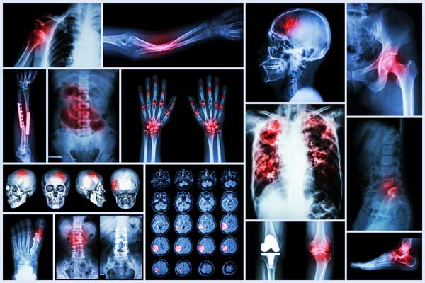 Multiple human X-rays