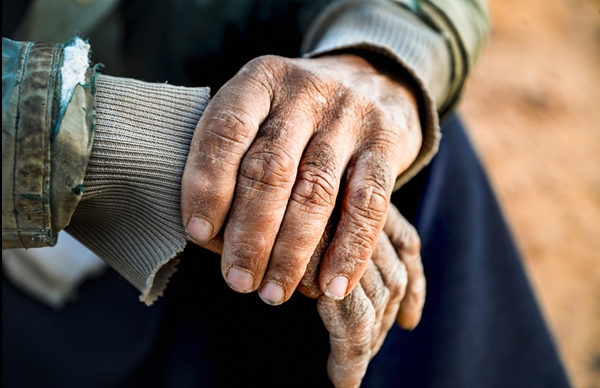 Close-up of an elderly person's weathered hands, one resting gently on top of the other. The hands show signs of age, with wrinkles and rough skin. The person is wearing a worn, layered jacket and sitting outdoors, possibly in a rural setting.