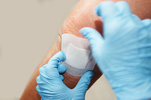 gloved hands applying wound care dressing